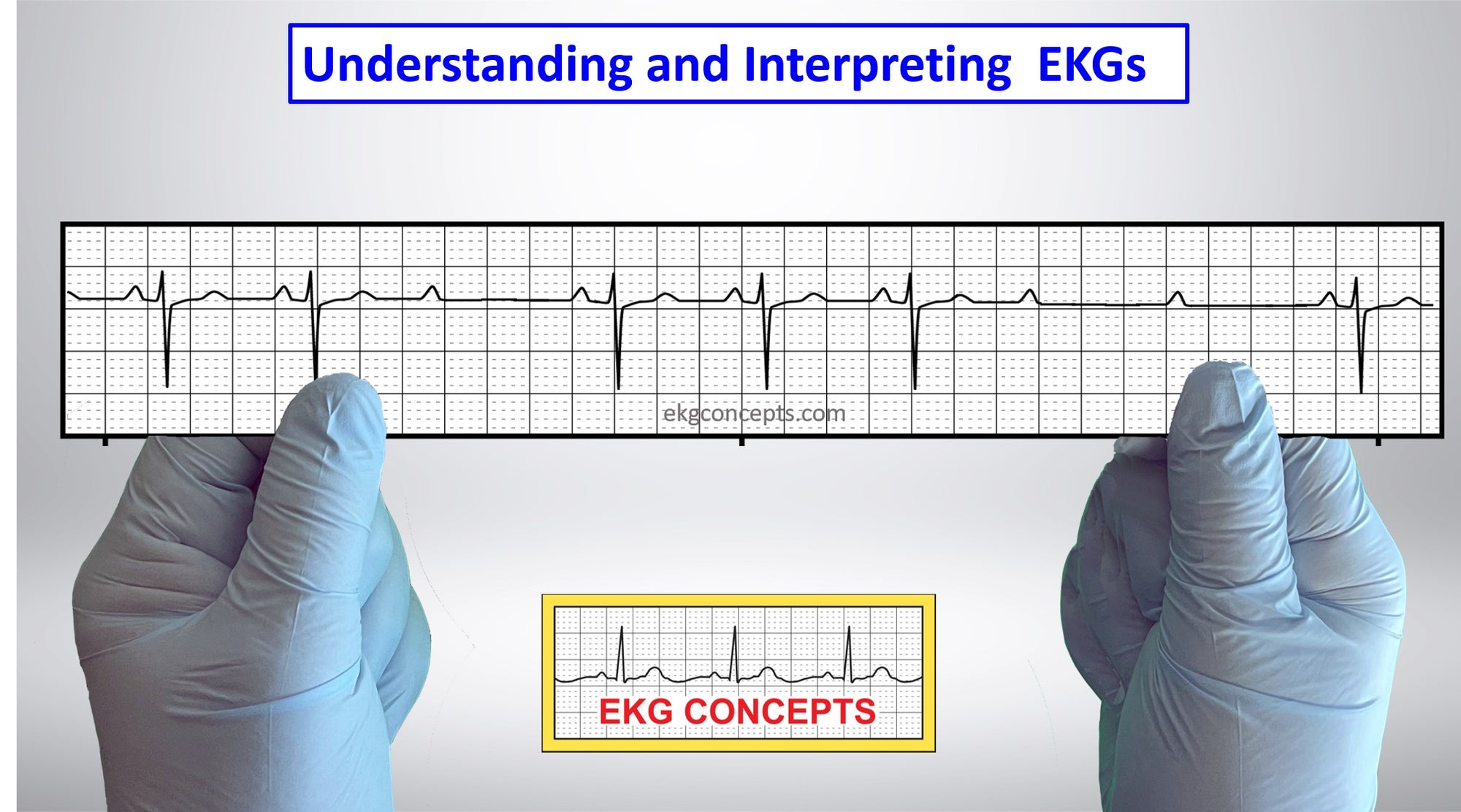 Q&A - EKG Basics